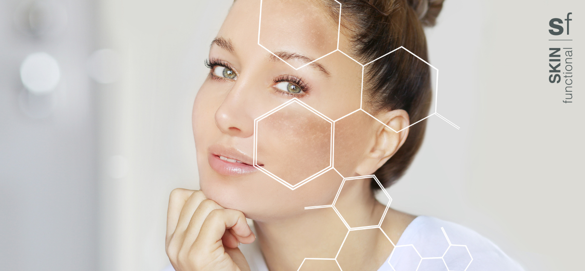 Hyperimpigmentation Skin Functional 4 common myths about hyperpigmentation